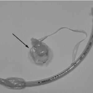 Endotracheal Tube: Curved High